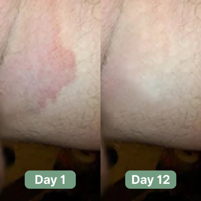 Nutracifica Antifungal Soap®