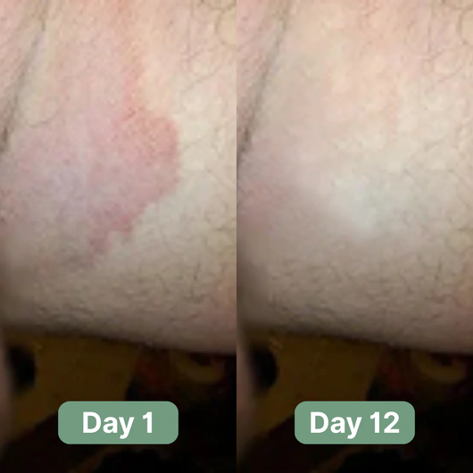 Nutracifica Antifungal Soap®