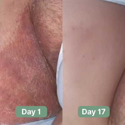 Nutracifica Antifungal Soap®