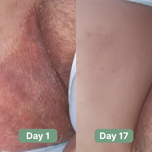 Nutracifica Antifungal Soap®